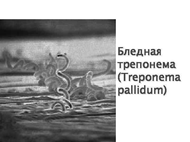 Бледная трепонема (Treponema pallidum) 