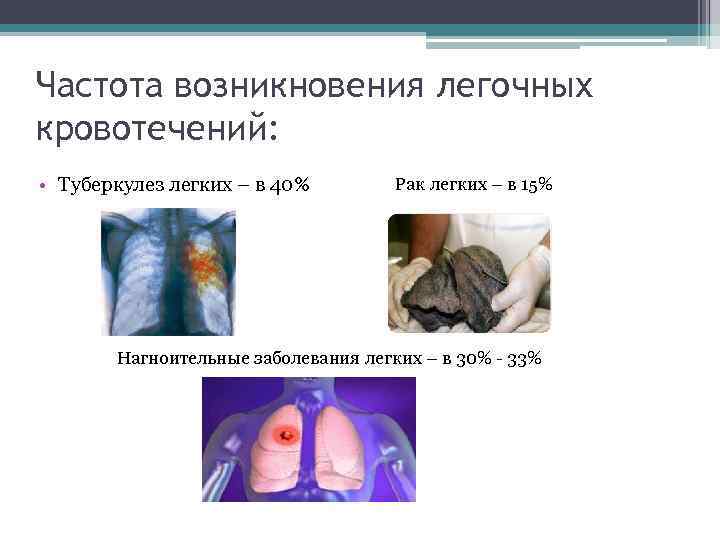 Частота возникновения легочных кровотечений: • Туберкулез легких – в 40% Рак легких – в