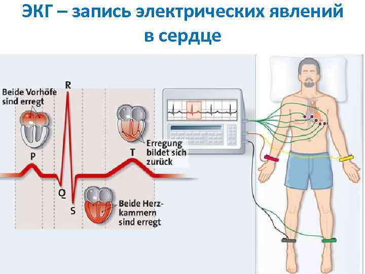 ЭКГ – запись электрических явлений в сердце 