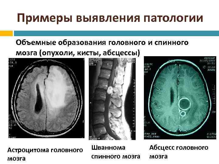 Образование головного мозга