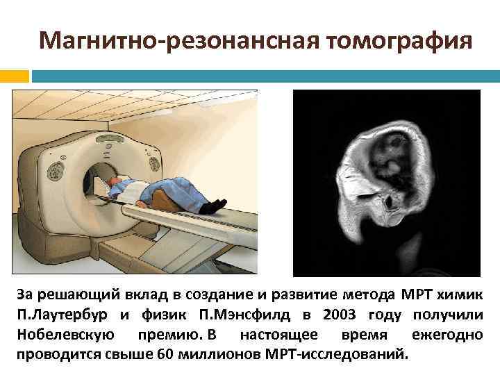 Магнитно-резонансная томография За решающий вклад в создание и развитие метода МРТ химик П. Лаутербур