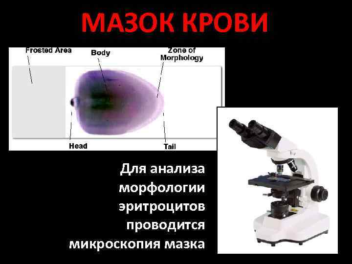 МАЗОК КРОВИ Для анализа морфологии эритроцитов проводится микроскопия мазка 11 