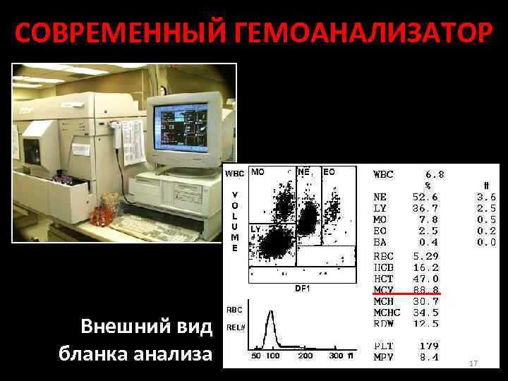 СОВРЕМЕННЫЙ ГЕМОАНАЛИЗАТОР Внешний вид бланка анализа 17 