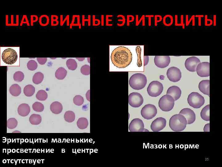 Посмотрите на изображение эритроцитов в разной среде