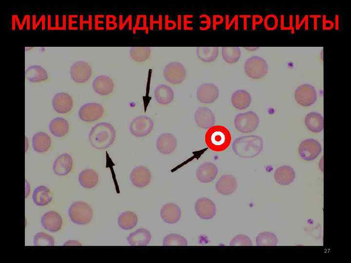 Посмотрите на изображение эритроцитов в разной среде в каком