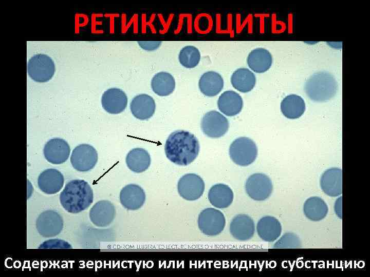 Посмотрите на изображение эритроцитов в разной среде в каком растворе находятся эритроциты на третье