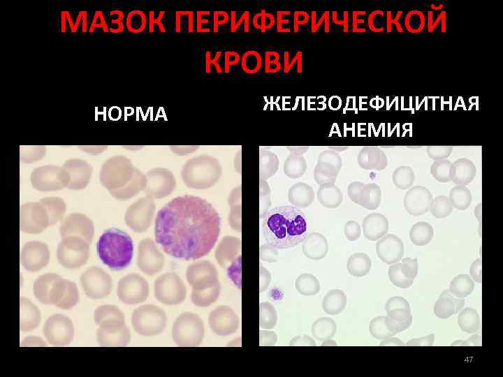 Эритроциты в мазке