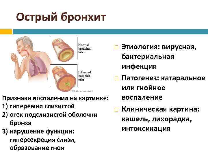 Бронхит симптомы у взрослых без температуры. Клинические симптомы бронхита у детей.