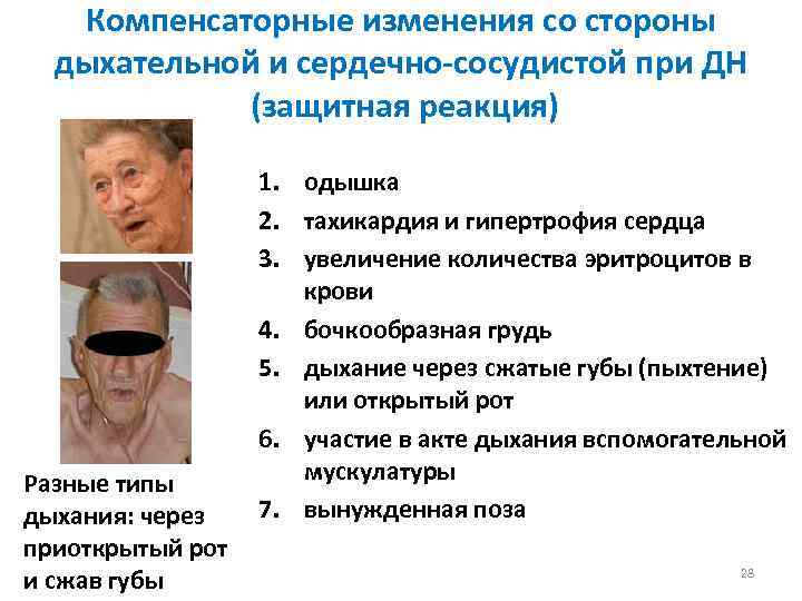 Компенсаторные изменения со стороны дыхательной и сердечно-сосудистой при ДН (защитная реакция) Разные типы дыхания: