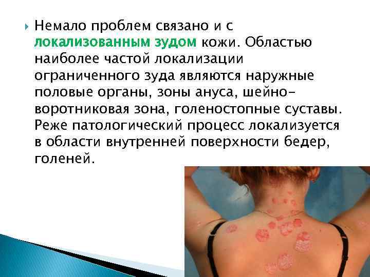  Немало проблем связано и с локализованным зудом кожи. Областью наиболее частой локализации ограниченного