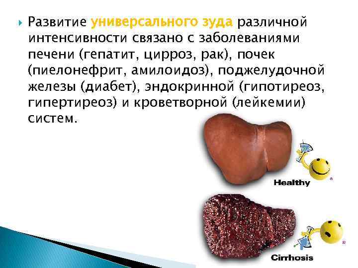  Развитие универсального зуда различной интенсивности связано с заболеваниями печени (гепатит, цирроз, рак), почек