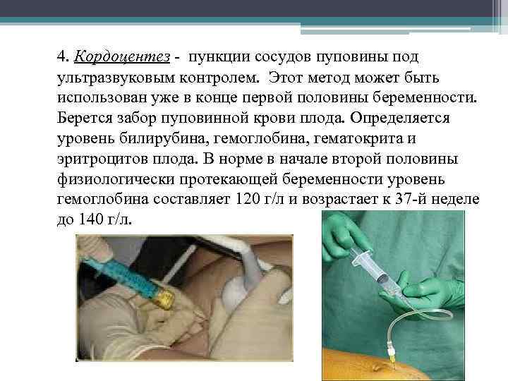 4. Кордоцентез - пункции сосудов пуповины под ультразвуковым контролем. Этот метод может быть использован