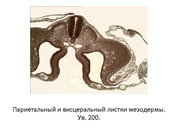 Париетальный и висцеральный листки мезодермы. Ув. 200. 