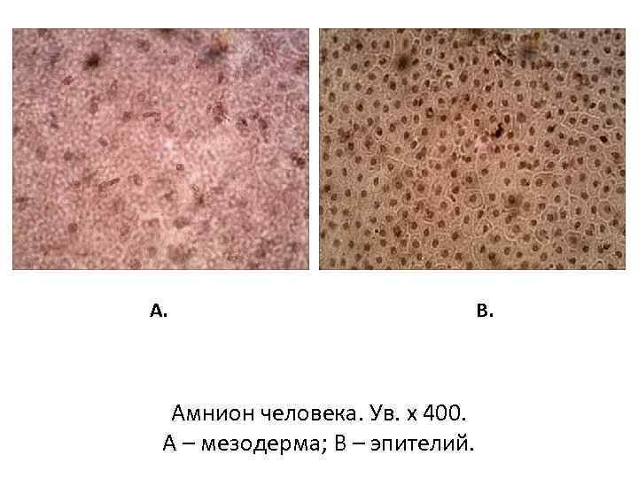 Зародышевые оболочки фото