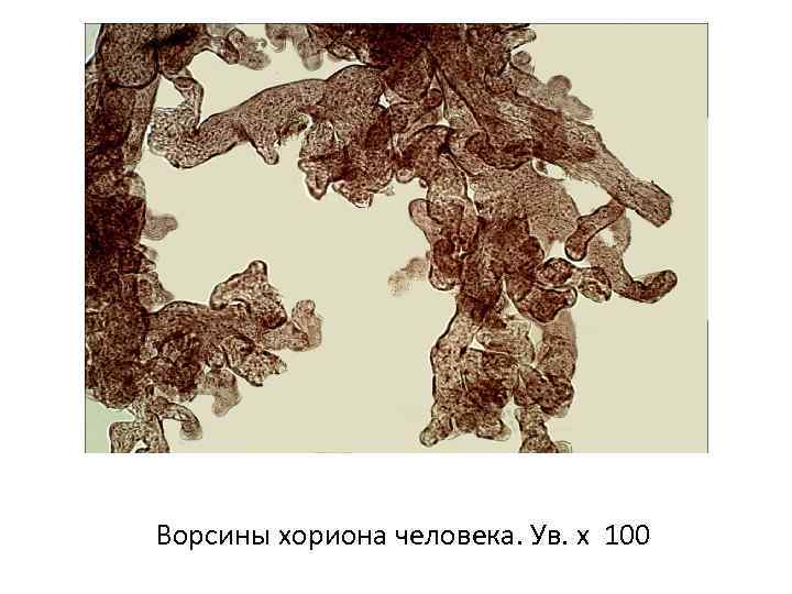 Ворсины хориона человека. Ув. х 100 