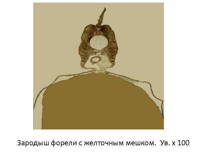 Зародыш форели с желточным мешком. Ув. х 100 