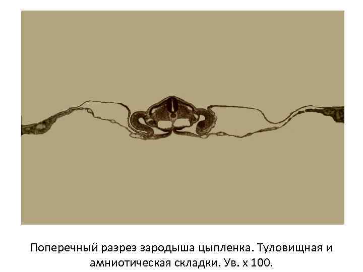 Поперечный разрез зародыша цыпленка. Туловищная и амниотическая складки. Ув. х 100. 