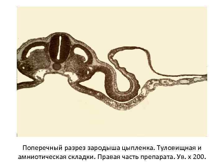 Поперечный разрез зародыша цыпленка. Туловищная и амниотическая складки. Правая часть препарата. Ув. х 200.