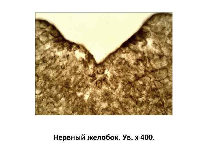 Нервный желобок. Ув. х 400. 