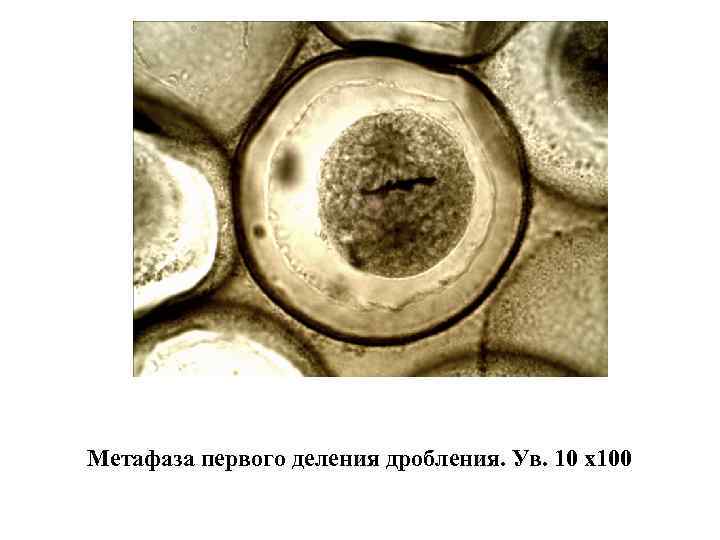 Метафаза первого деления дробления. Ув. 10 х100 