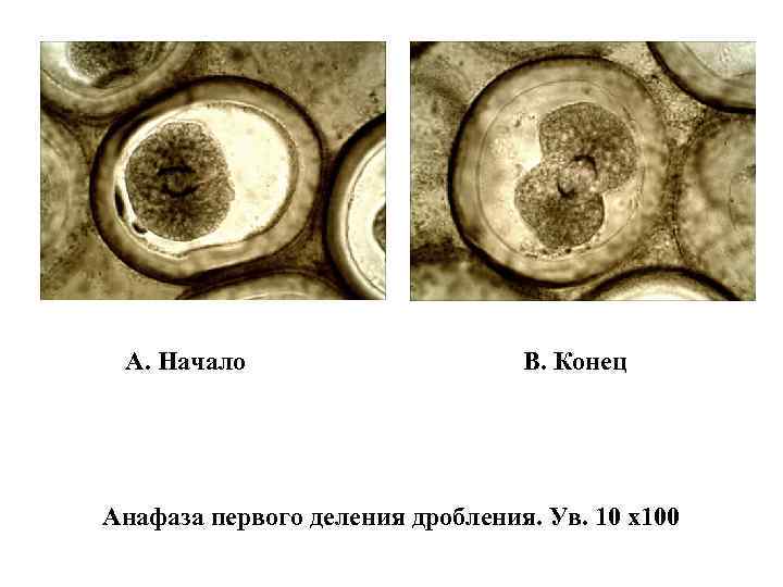 А. Начало В. Конец Анафаза первого деления дробления. Ув. 10 х100 