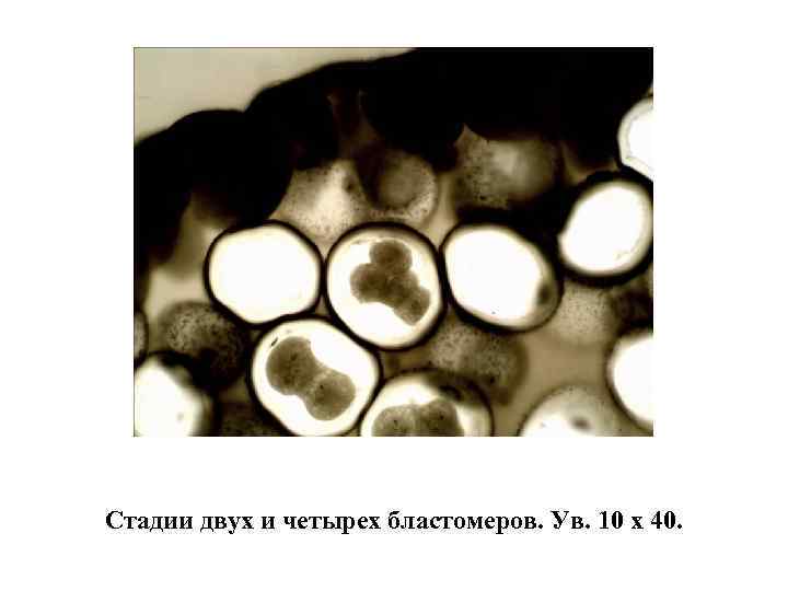 Стадии двух и четырех бластомеров. Ув. 10 х 40. 
