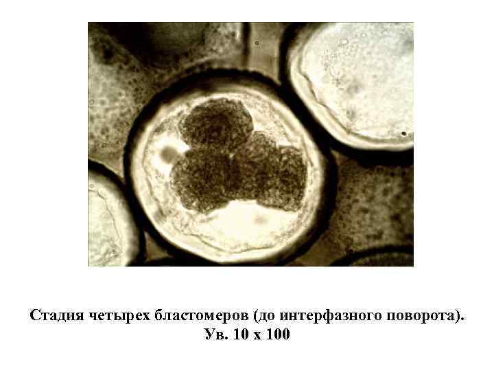 Стадия четырех бластомеров (до интерфазного поворота). Ув. 10 х 100 