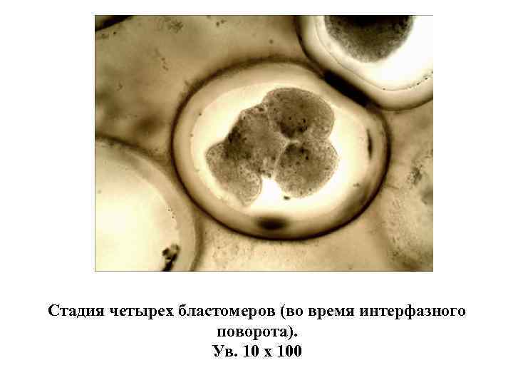 Стадия четырех бластомеров (во время интерфазного поворота). Ув. 10 х 100 