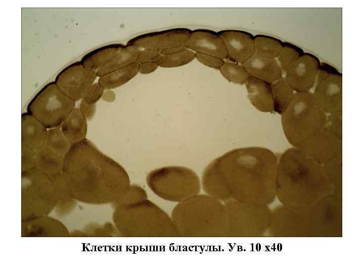 Клетки крыши бластулы. Ув. 10 х40 