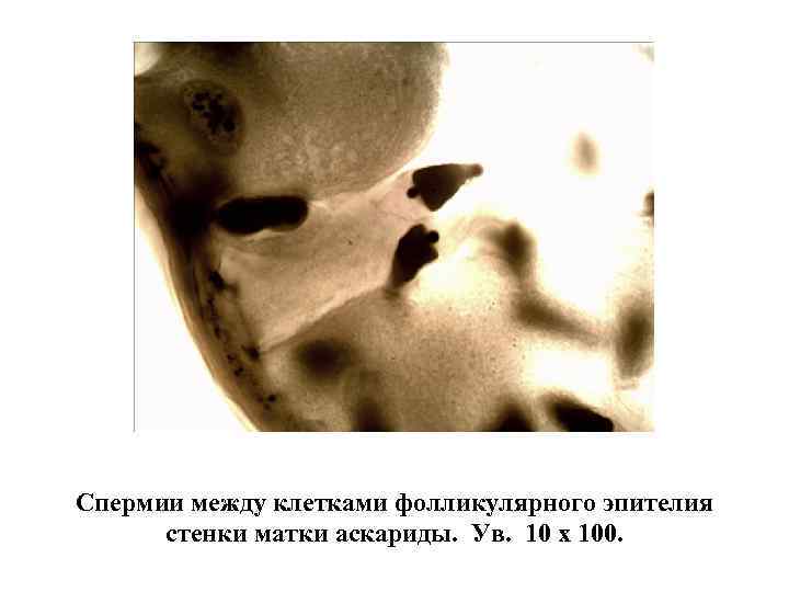 Спермии между клетками фолликулярного эпителия стенки матки аскариды. Ув. 10 х 100. 