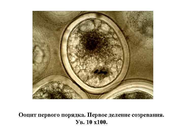 В растущих ооцитах большинства животных. Деления созревания яйцеклетки аскариды. Деление созревания яйцеклетки лошадиной аскариды. Ооциты первого порядка. Ооцит i порядка.