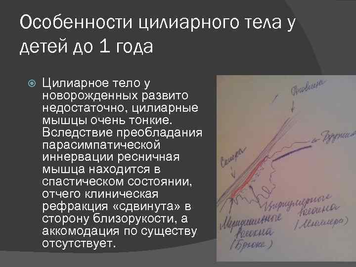 Особенности цилиарного тела у детей до 1 года Цилиарное тело у новорожденных развито недостаточно,