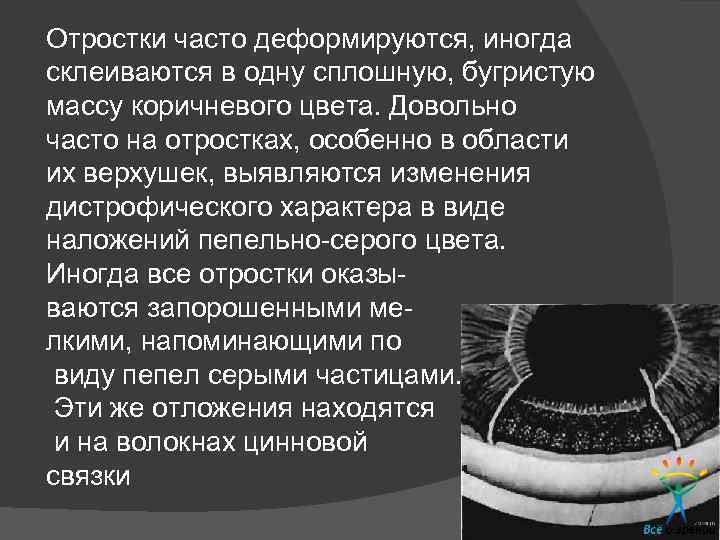 Отростки часто деформируются, иногда склеиваются в одну сплошную, бугристую массу коричневого цвета. Довольно часто