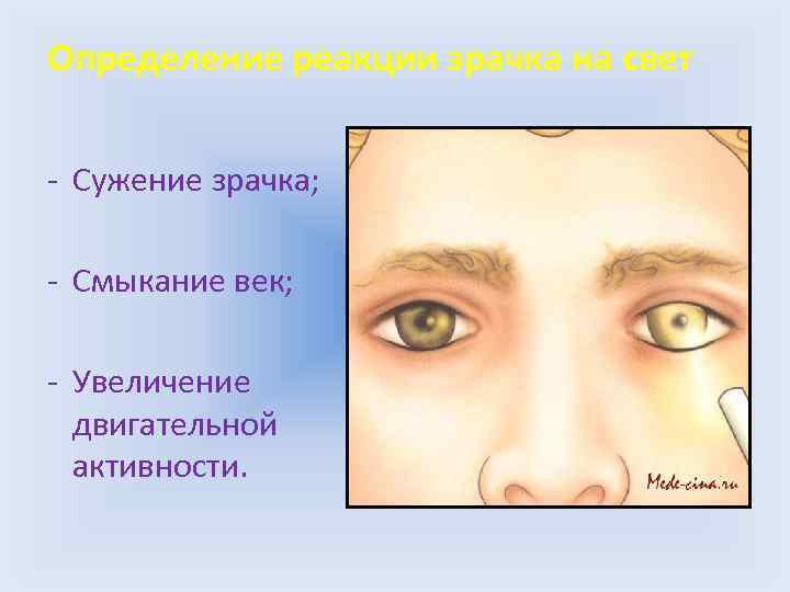 Определение реакции зрачка на свет - Сужение зрачка; - Смыкание век; - Увеличение двигательной