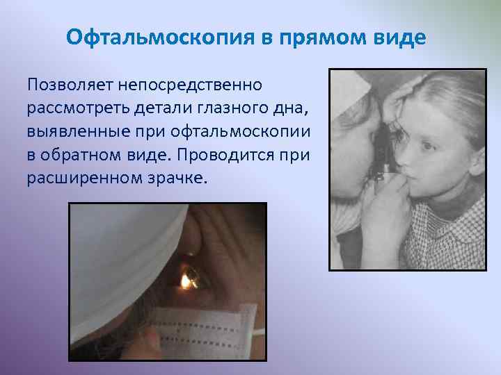 Офтальмоскопия в прямом виде Позволяет непосредственно рассмотреть детали глазного дна, выявленные при офтальмоскопии в