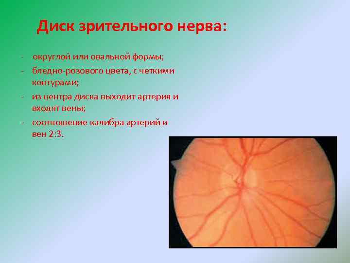 Диск зрительного нерва: - округлой или овальной формы; - бледно-розового цвета, с четкими контурами;