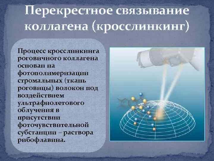Перекрестное связывание коллагена (кросслинкинг) Процесс кросслинкинга роговичного коллагена основан на фотополимеризации стромальных (ткань роговицы)