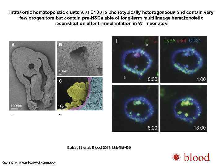 Intraaortic hematopoietic clusters at E 10 are phenotypically heterogeneous and contain very few progenitors