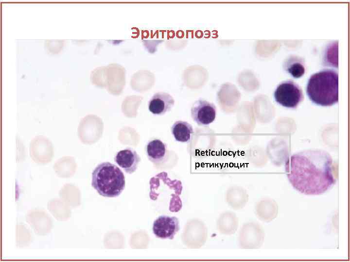 Эритропоэз Reticulocyte ретикулоцит 