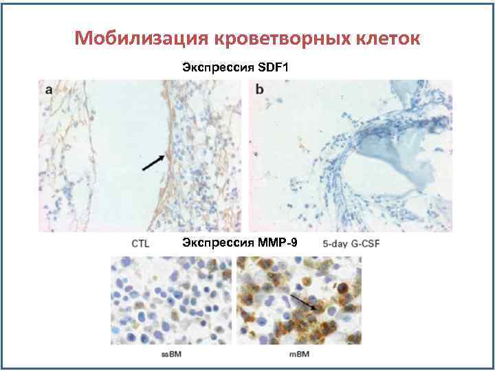 Мобилизация кроветворных клеток Экспрессия SDF 1 Экспрессия MMP-9 