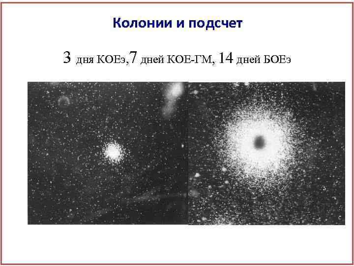 Колонии и подсчет 3 дня КОЕэ, 7 дней КОЕ-ГМ, 14 дней БОЕэ 