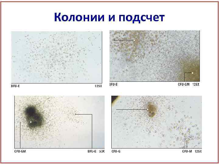 Колонии и подсчет 