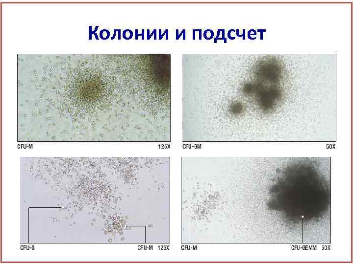 Колонии и подсчет 