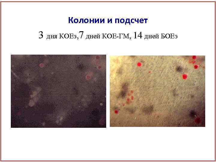 Колонии и подсчет 3 дня КОЕэ, 7 дней КОЕ-ГМ, 14 дней БОЕэ 