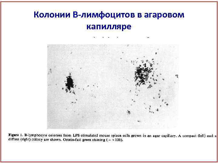 Колонии В-лимфоцитов в агаровом капилляре 