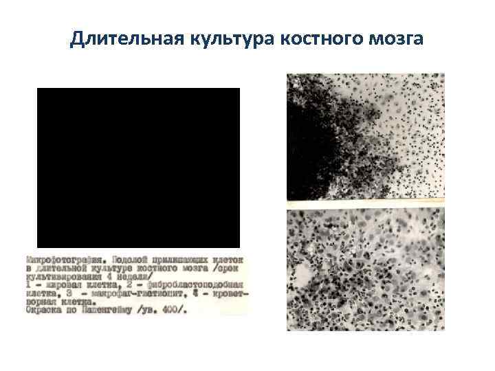 Длительная культура костного мозга 