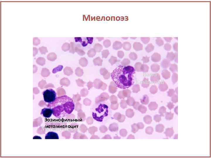 Миелопоэз Эозинофильный метамиелоцит 