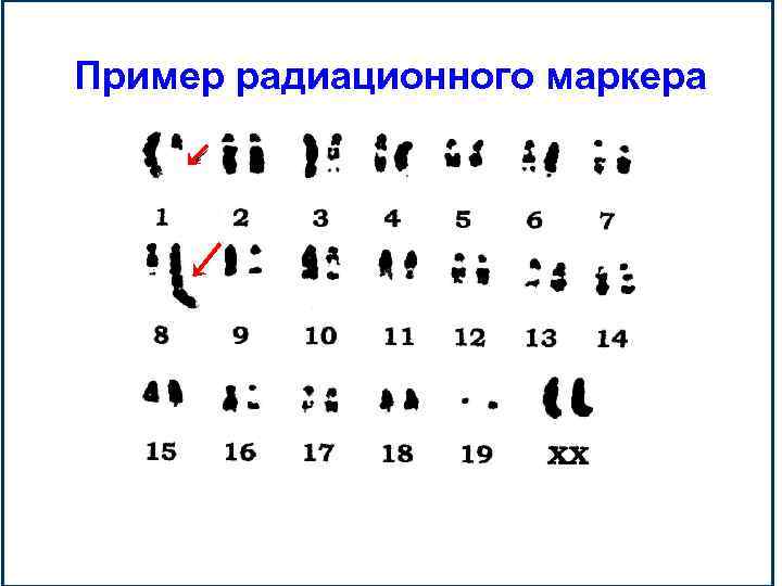 Пример радиационного маркера 