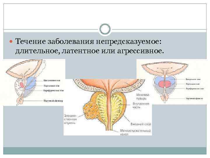  Течение заболевания непредсказуемое: длительное, латентное или агрессивное. 