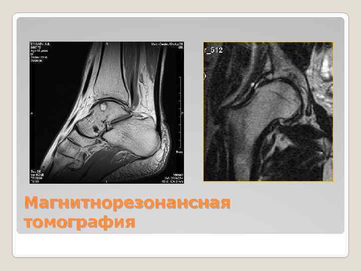 Магнитнорезонансная томография 